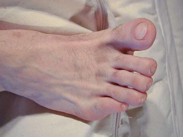 Foot Friends | David