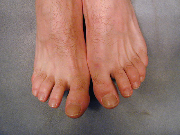 Foot Friends | Matt's Sandals
