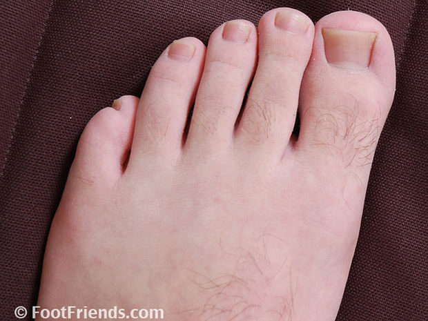 Foot Friends | Adam