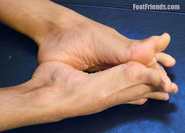 Foot Friends | Marco